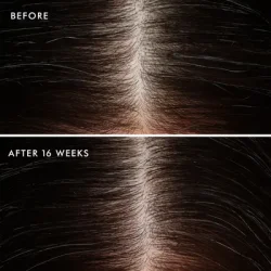 Moroccanoil Scalp Revitalizing Scalp Tonic 100 ml