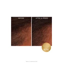 Moroccanoil Scalp Revitalizing Scalp Tonic 100 ml